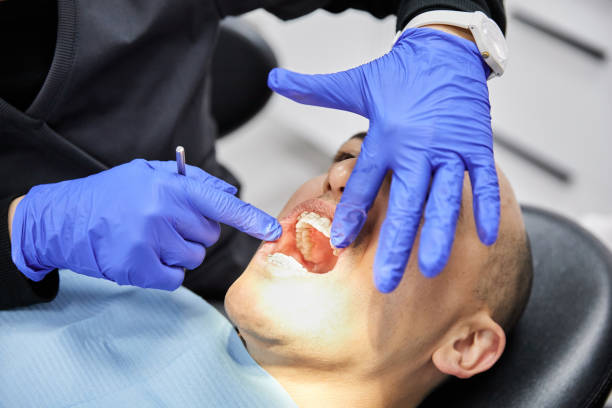 Best Emergency Root Canal Treatment in Brookmont, MD