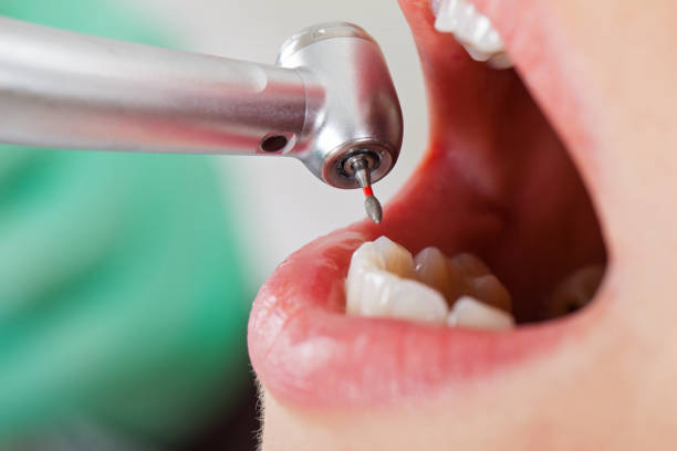 Best Walk-In Emergency Dentist in Brookmont, MD